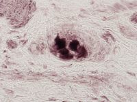 Normales Ganglion NOS (x400)