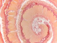 Desmosis coli x1 25 Desmosis coli x1 25