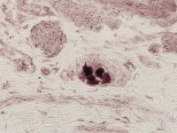 Normales Ganglion NOS (x400)