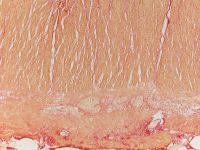 Desmosis coli x200